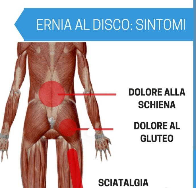 Ernie e protrusioni: puoi allenarti con esercizi specifici.